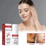 DARK SPOT CREAM - Image 6