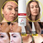 DARK SPOT CREAM - Image 3